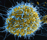 filamentous-ebolavirus-particles-scanning-electron-micrograph-cell